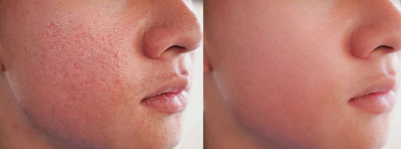 Before & After